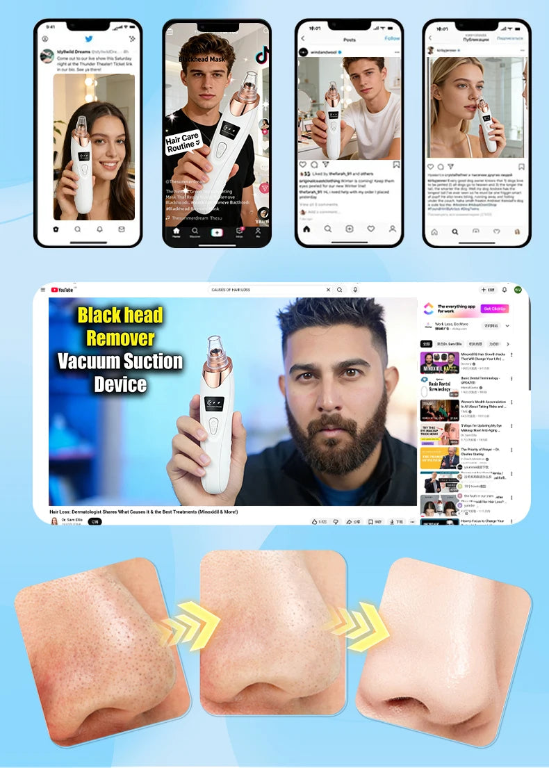 Blackhead Remover Pore Cleaner Black Dots Vacuum Cleaner Skin Pimple Acne Extractor Facial Cleaning Electric Black Head Removal.