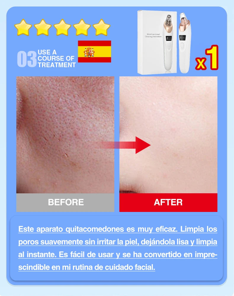 Blackhead Remover Pore Cleaner Black Dots Vacuum Cleaner Skin Pimple Acne Extractor Facial Cleaning Electric Black Head Removal.