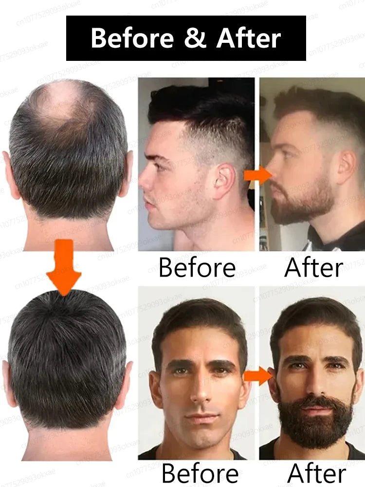 A must-have for every man, this beard transformation tool! From sparse to thick, from frizzy to smooth.