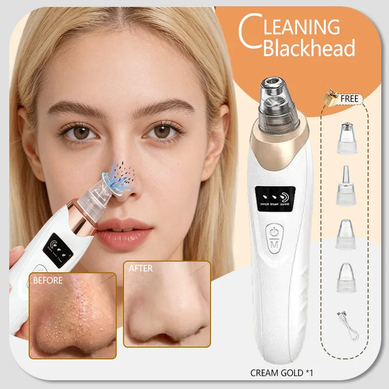 Blackhead Remover Pore Cleaner Black Dots Vacuum Cleaner Skin Pimple Acne Extractor Facial Cleaning Electric Black Head Removal.
