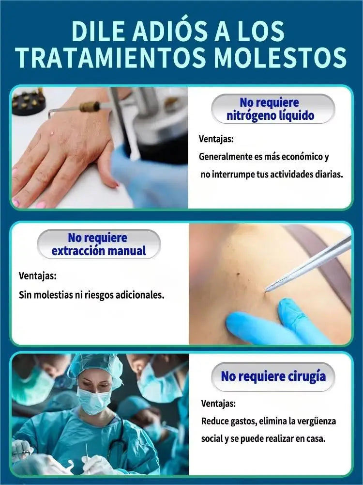 Hot selling blue light pen to solve body warts, wart care tools