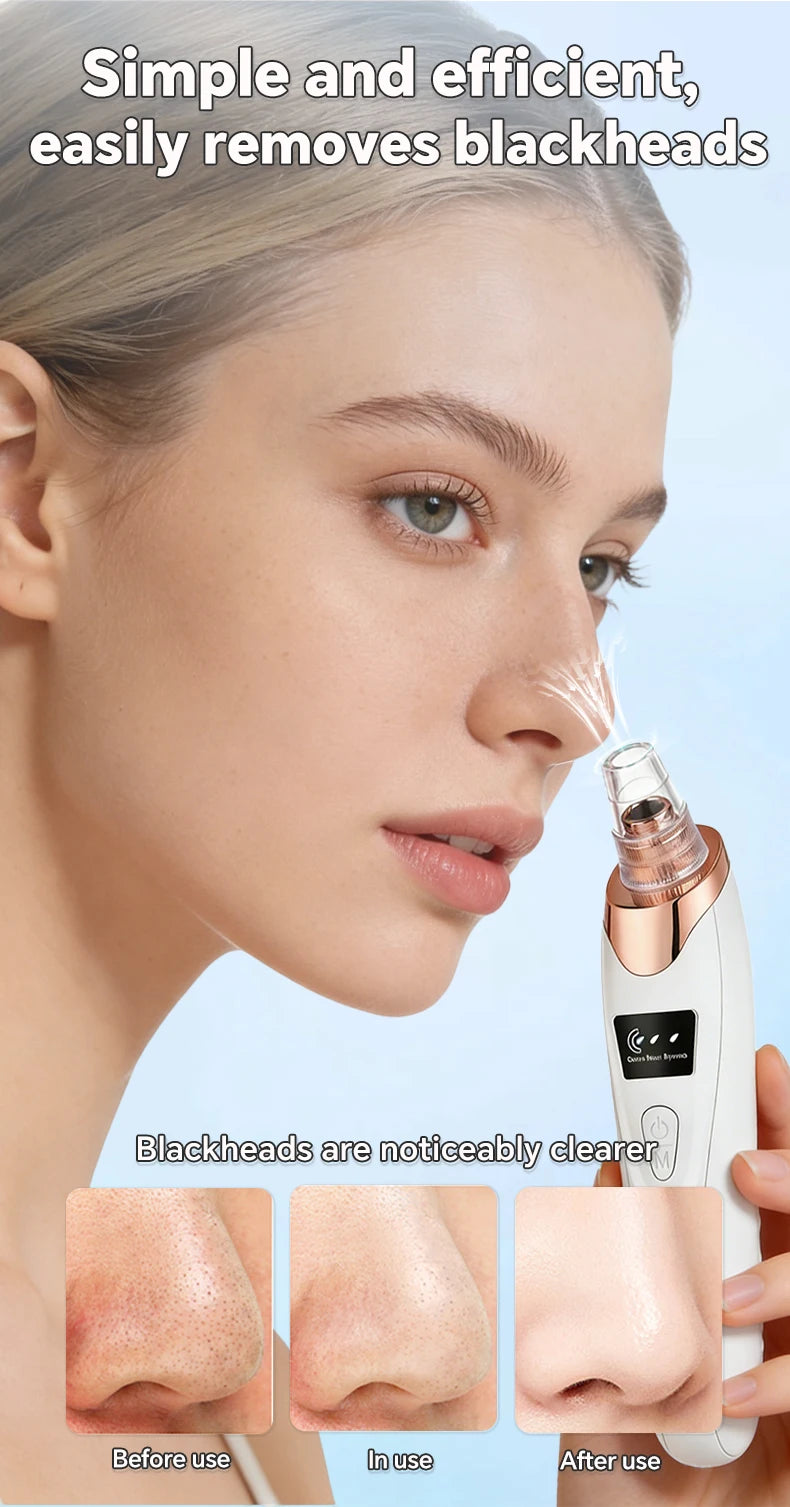 Blackhead Remover Pore Cleaner Black Dots Vacuum Cleaner Skin Pimple Acne Extractor Facial Cleaning Electric Black Head Removal.