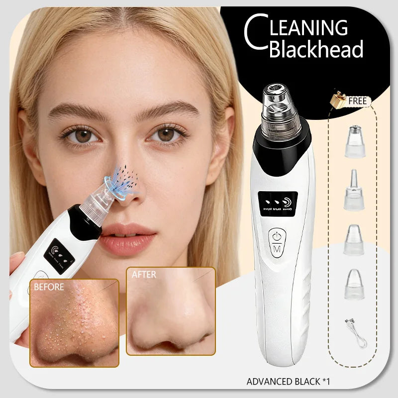 Blackhead Remover Pore Cleaner Black Dots Vacuum Cleaner Skin Pimple Acne Extractor Facial Cleaning Electric Black Head Removal.