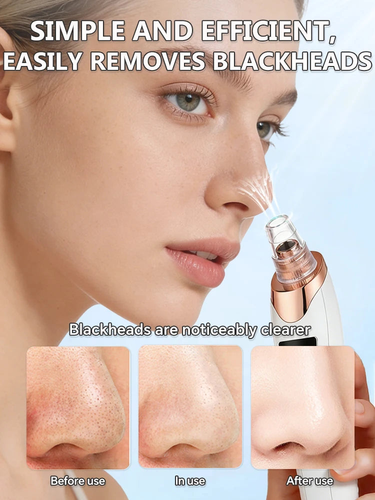 Blackhead Remover Pore Cleaner Black Dots Vacuum Cleaner Skin Pimple Acne Extractor Facial Cleaning Electric Black Head Removal.