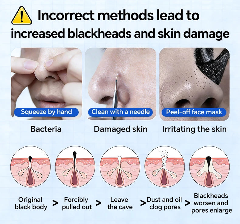 Blackhead Remover Pore Cleaner Black Dots Vacuum Cleaner Skin Pimple Acne Extractor Facial Cleaning Electric Black Head Removal.