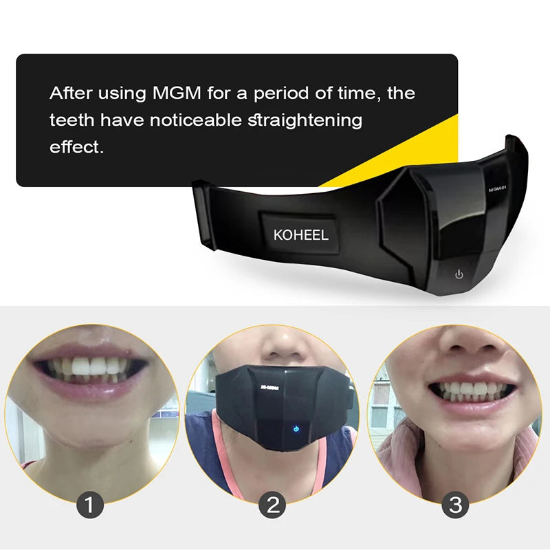 KOHEEL MGM Teeth Straightener with Harmonic Vibration, Orthodontics Retainer and Teeth Aligner Braces